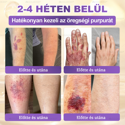Magyarországon gyártva és szállítva ✨ 𝐆𝐎𝐋𝐃𝐊𝐈𝐒𝐒® 𝐆𝐇𝐊-𝐂𝐮 & 𝐁𝐈𝐎𝐓𝐈𝐍 𝟏𝟎-𝐢𝐧-𝟏 Bőrmegújító Krém ⚡