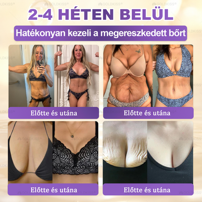 Magyarországon gyártva és szállítva ✨ 𝐆𝐎𝐋𝐃𝐊𝐈𝐒𝐒® 𝐆𝐇𝐊-𝐂𝐮 & 𝐁𝐈𝐎𝐓𝐈𝐍 𝟏𝟎-𝐢𝐧-𝟏 Bőrmegújító Krém ⚡
