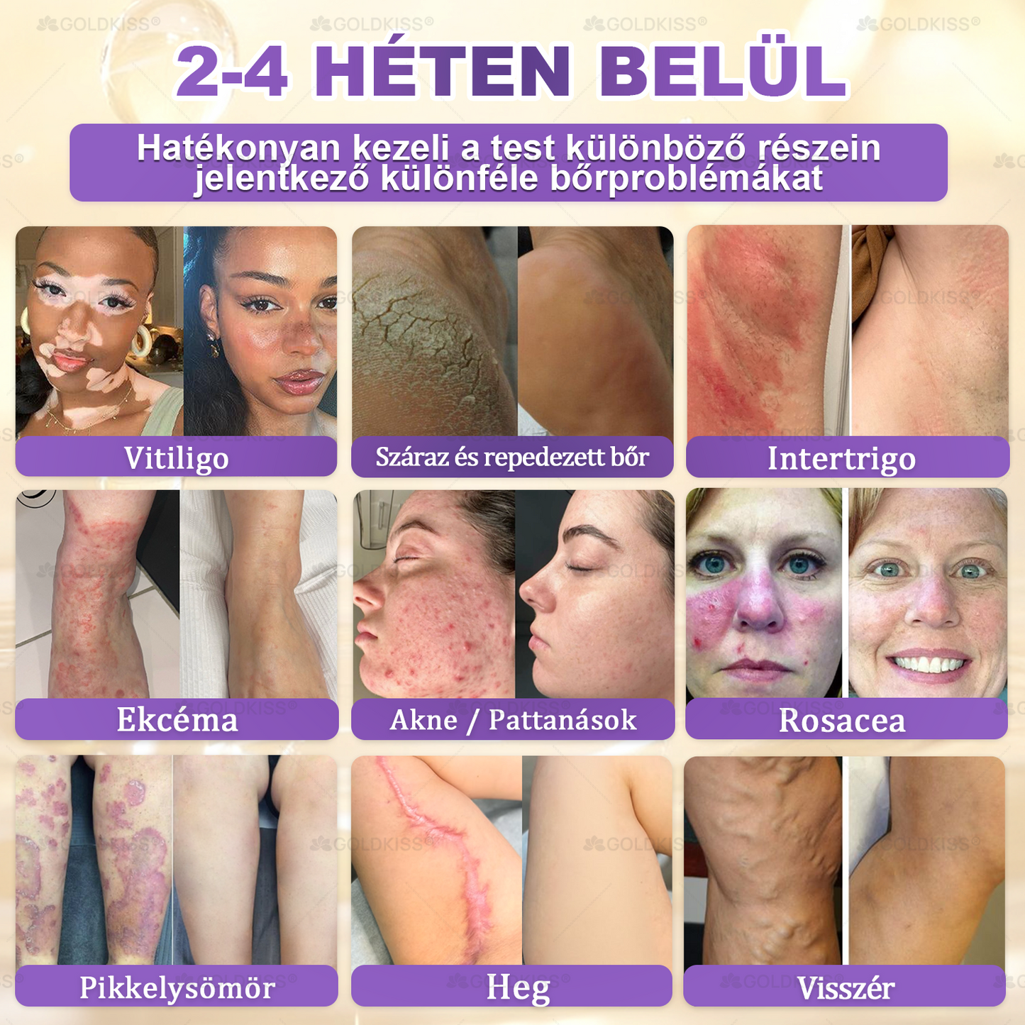 Magyarországon gyártva és szállítva ✨ 𝐆𝐎𝐋𝐃𝐊𝐈𝐒𝐒® 𝐆𝐇𝐊-𝐂𝐮 & 𝐁𝐈𝐎𝐓𝐈𝐍 𝟏𝟎-𝐢𝐧-𝟏 Bőrmegújító Krém ⚡
