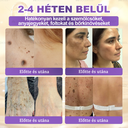 Magyarországon gyártva és szállítva ✨ 𝐆𝐎𝐋𝐃𝐊𝐈𝐒𝐒® 𝐆𝐇𝐊-𝐂𝐮 & 𝐁𝐈𝐎𝐓𝐈𝐍 𝟏𝟎-𝐢𝐧-𝟏 Bőrmegújító Krém ⚡