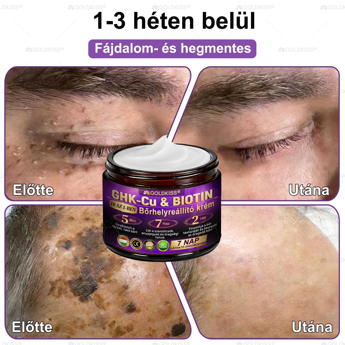 Magyarországon gyártva és szállítva ✨ 𝐆𝐎𝐋𝐃𝐊𝐈𝐒𝐒® 𝐆𝐇𝐊-𝐂𝐮 & 𝐁𝐈𝐎𝐓𝐈𝐍 𝟏𝟎-𝐢𝐧-𝟏 Bőrmegújító Krém ⚡