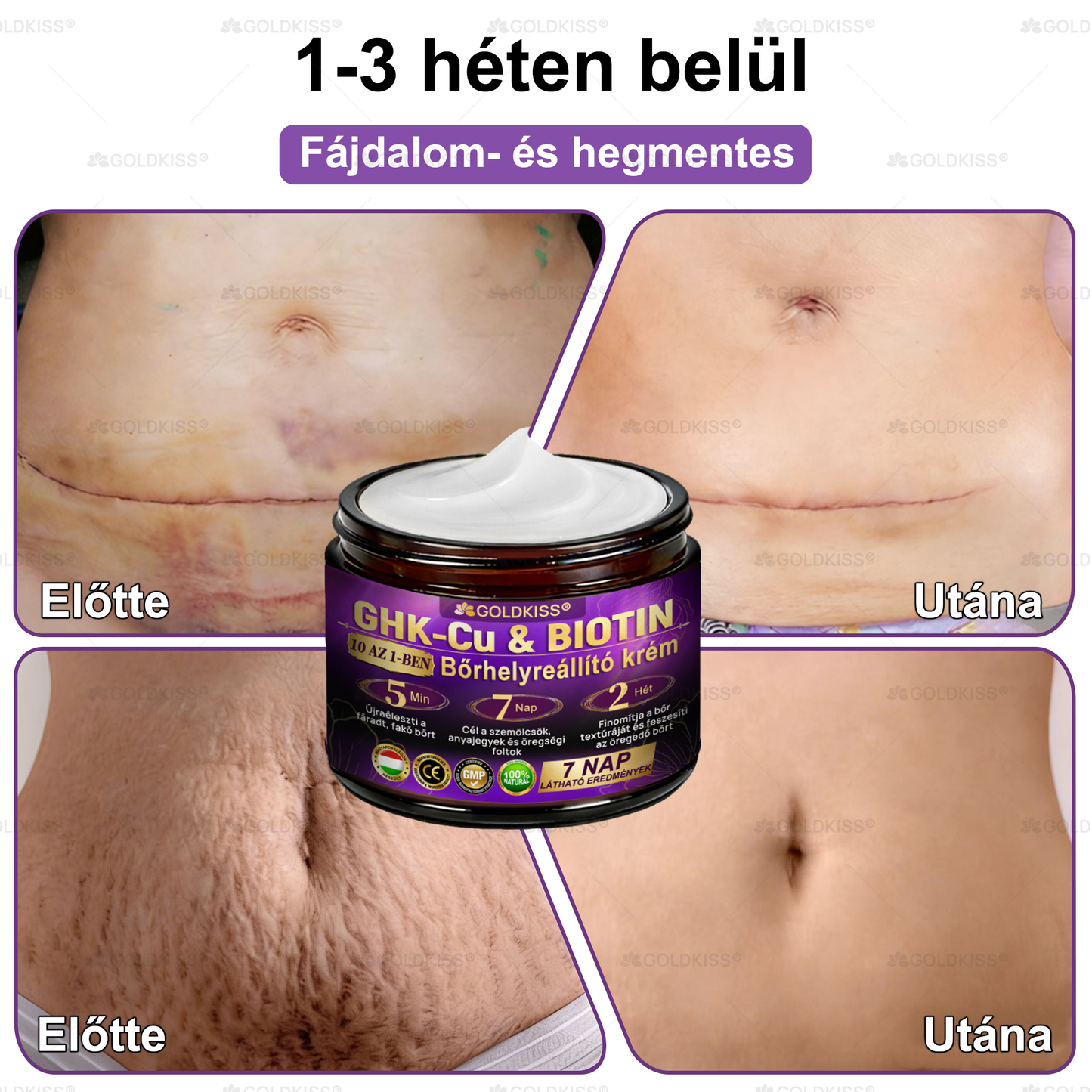 Magyarországon gyártva és szállítva ✨ 𝐆𝐎𝐋𝐃𝐊𝐈𝐒𝐒® 𝐆𝐇𝐊-𝐂𝐮 & 𝐁𝐈𝐎𝐓𝐈𝐍 𝟏𝟎-𝐢𝐧-𝟏 Bőrmegújító Krém ⚡