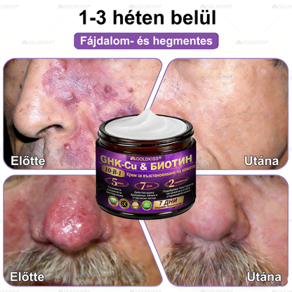 Magyarországon gyártva és szállítva ✨ 𝐆𝐎𝐋𝐃𝐊𝐈𝐒𝐒® 𝐆𝐇𝐊-𝐂𝐮 & 𝐁𝐈𝐎𝐓𝐈𝐍 𝟏𝟎-𝐢𝐧-𝟏 Bőrmegújító Krém ⚡